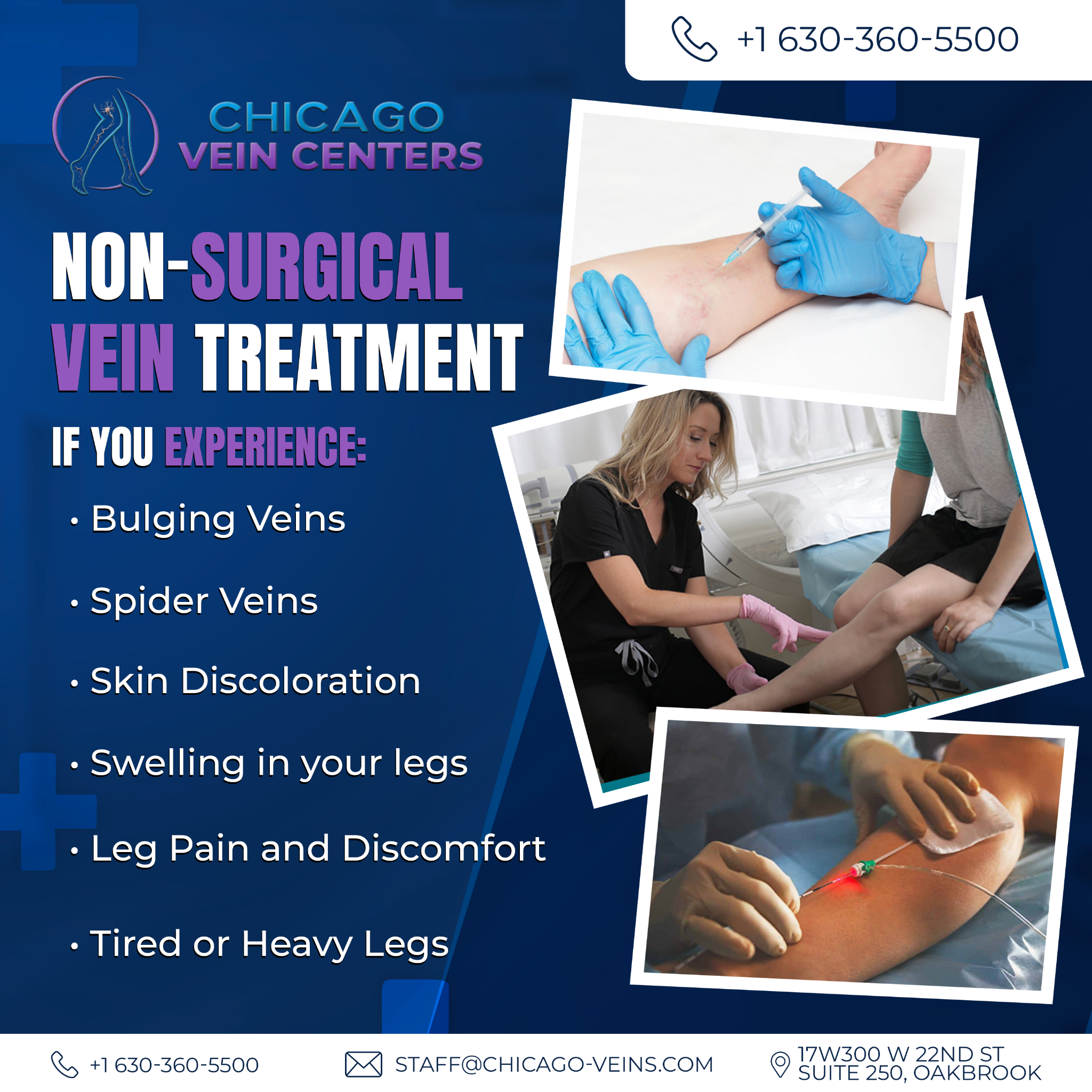 Chicago Vein Centers Facebook ad: Book Appointment!