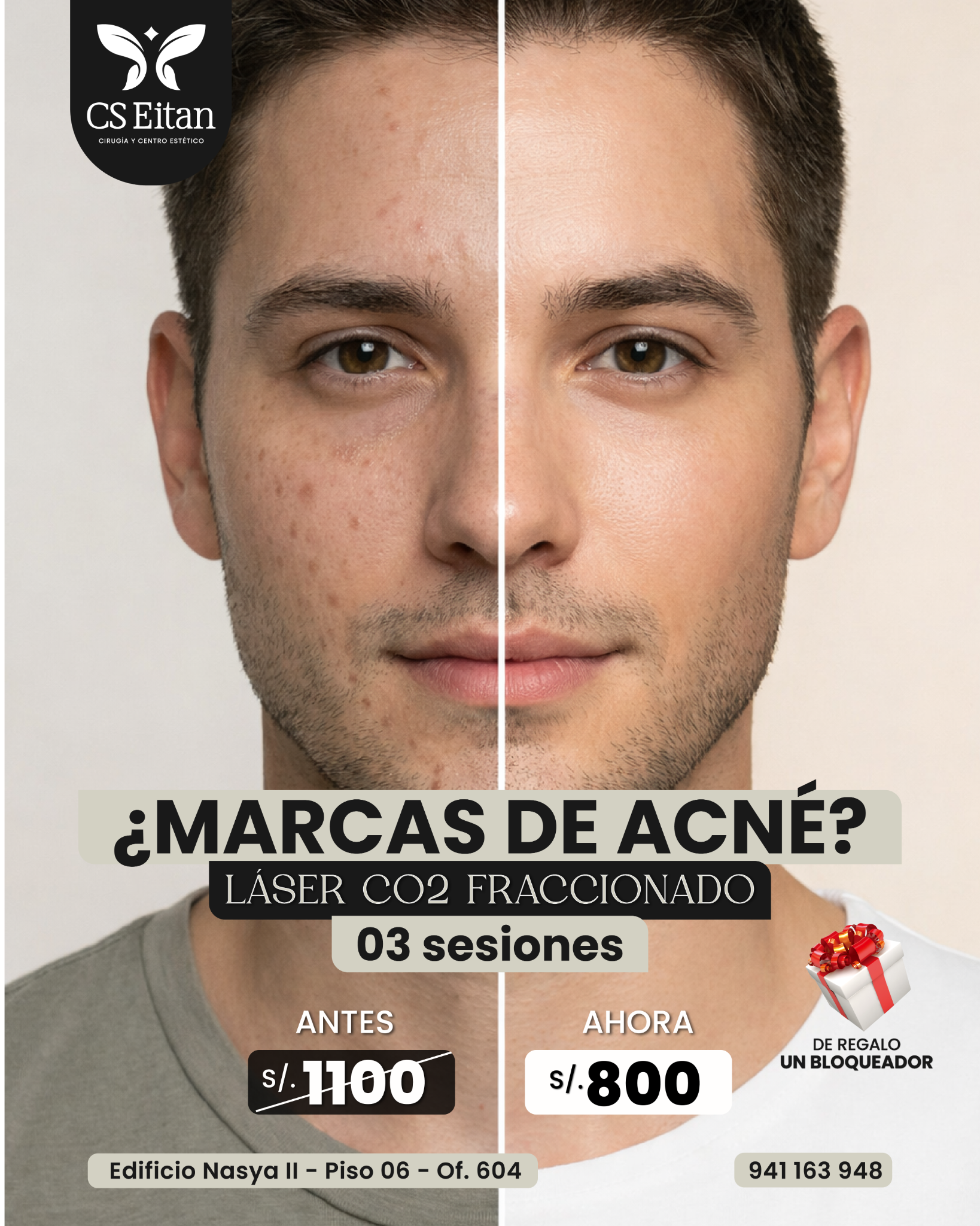 CS EITAN Cirugía y Centro Estético Facebook ad: Chatea con nosotros
