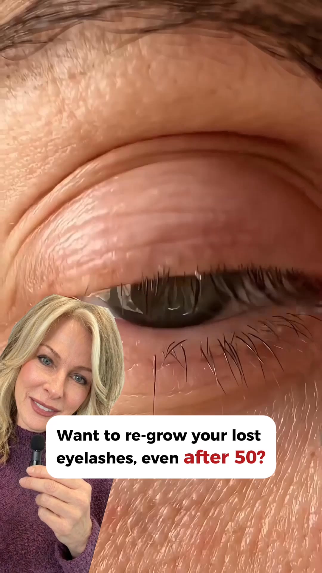 Lash by Susana Facebook ad: Better Than Latisse?