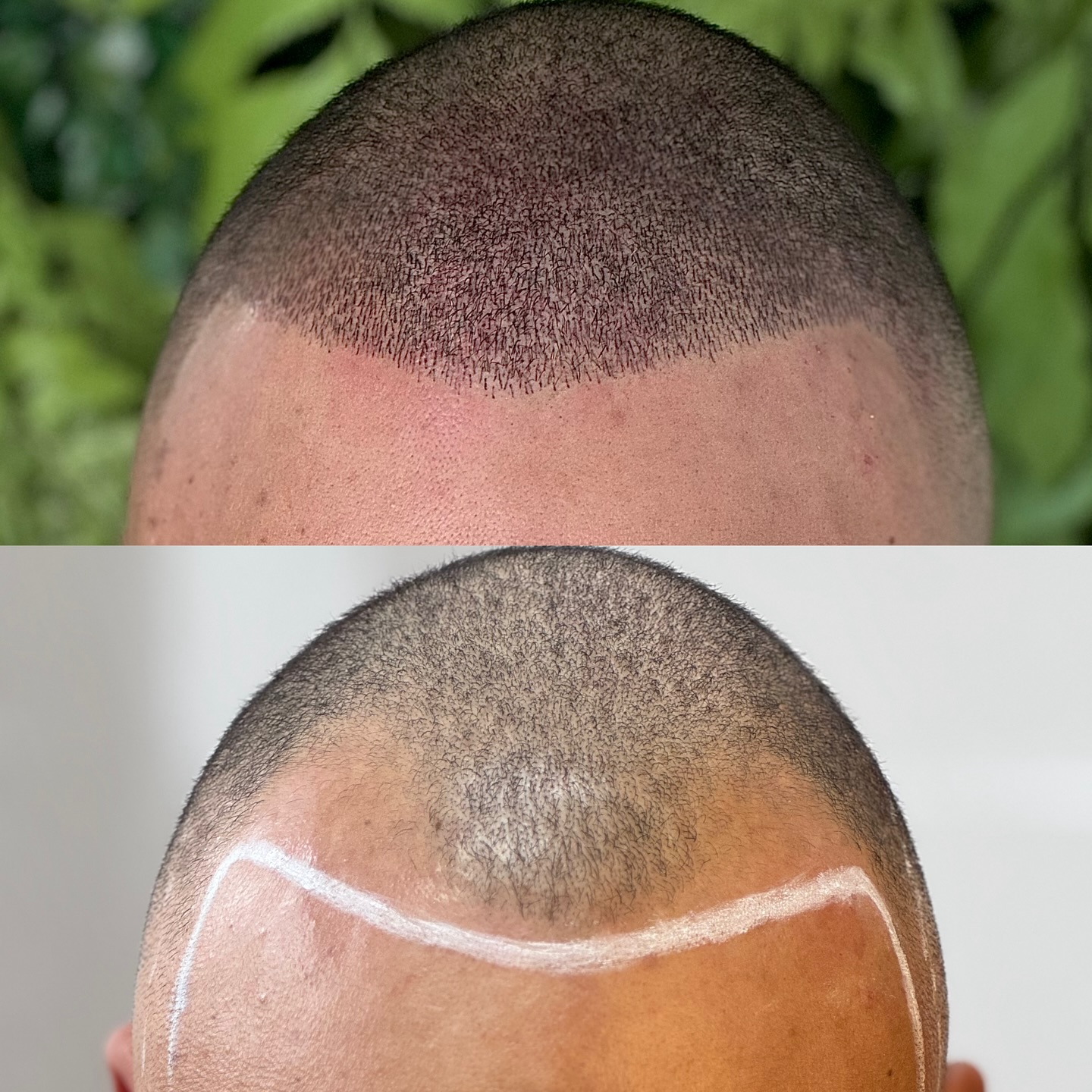 Micropigmentação & Estética Facebook ad: Fios realistas Técnica exclusiva realizada em única sessão!