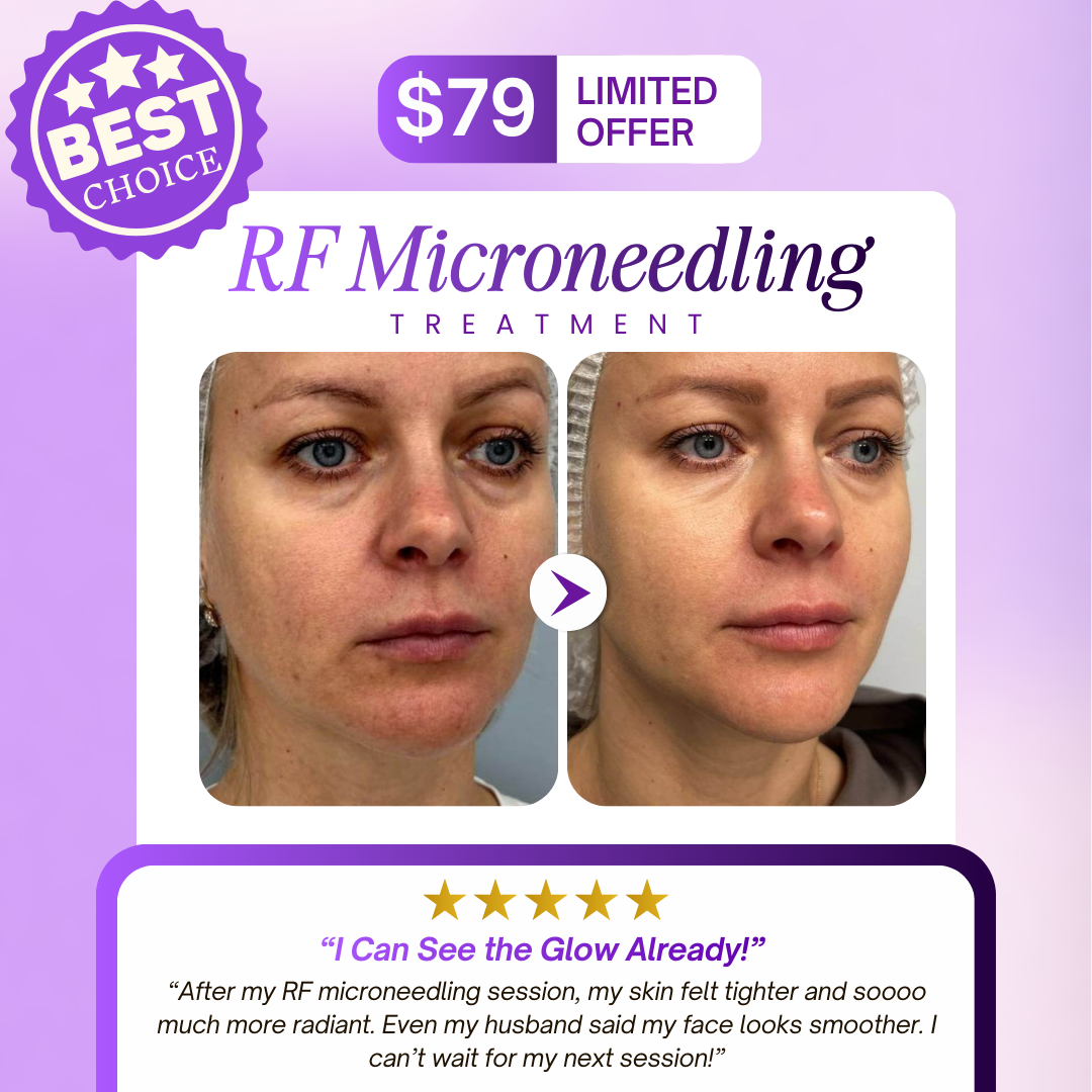 Love My Skin Treatments Facebook ad