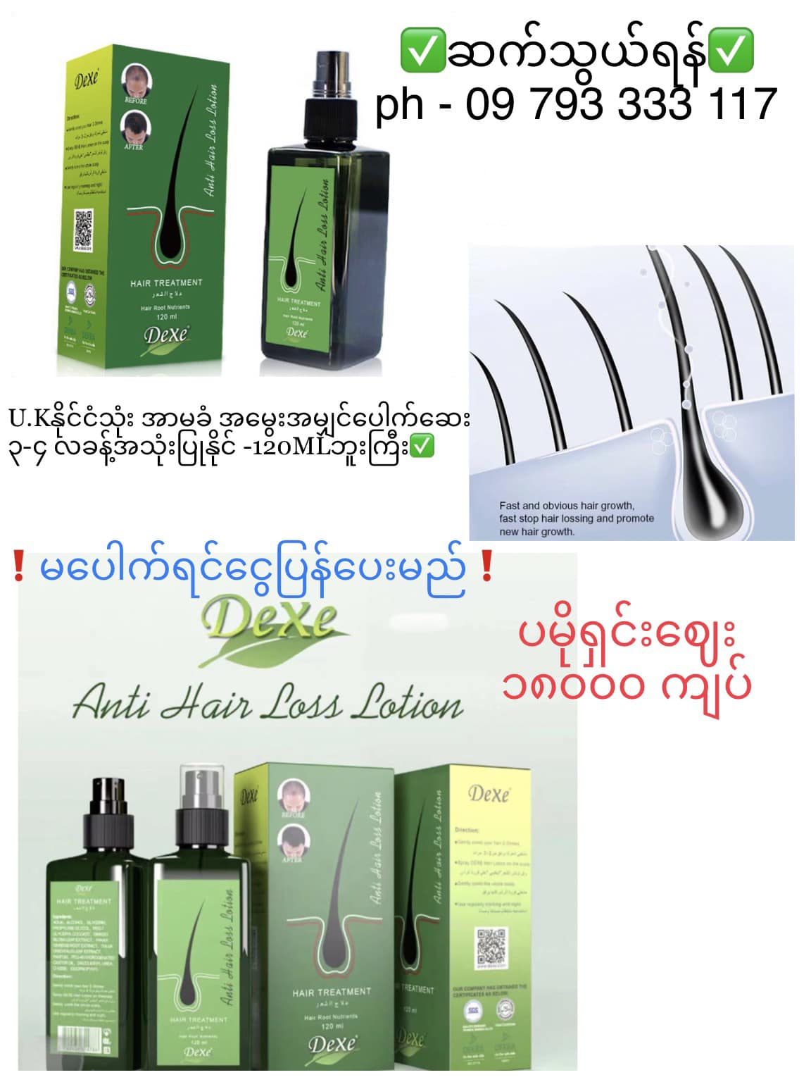 အာမခံ ဆံပင်ပေါက်ဆေး- Dexe ဒီဇီ ဆံပင်ထူသန်ပေါက်ဆေး Facebook ad: မပေါက်ပါကငွေပြန်အမ်းမည် စေးကပ်မှုမရှိသောအာမခံအမွေးမျှင်ပေါက…