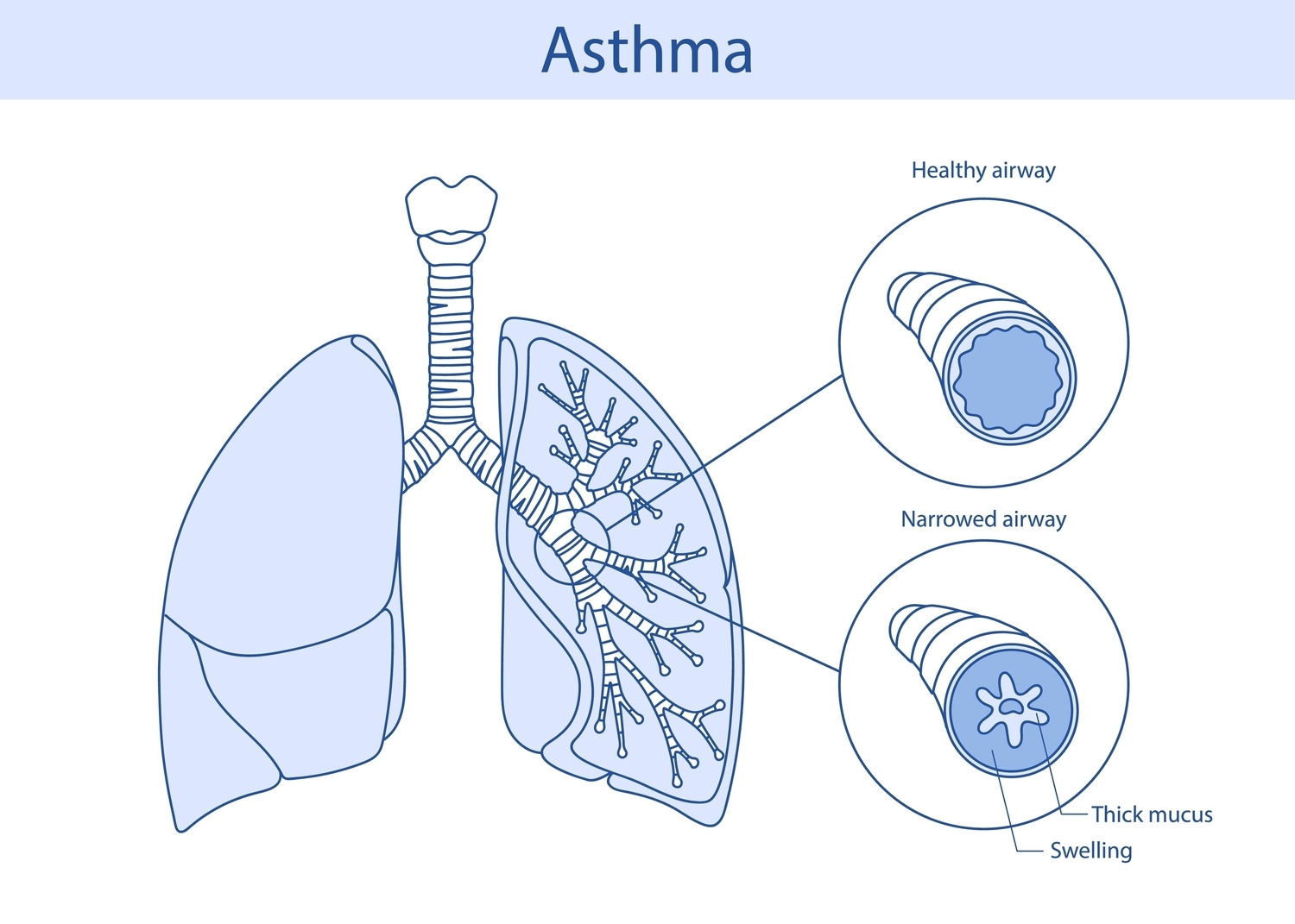 First Healthy Living Facebook ad: Find a Specialist for Better Asthma Control
