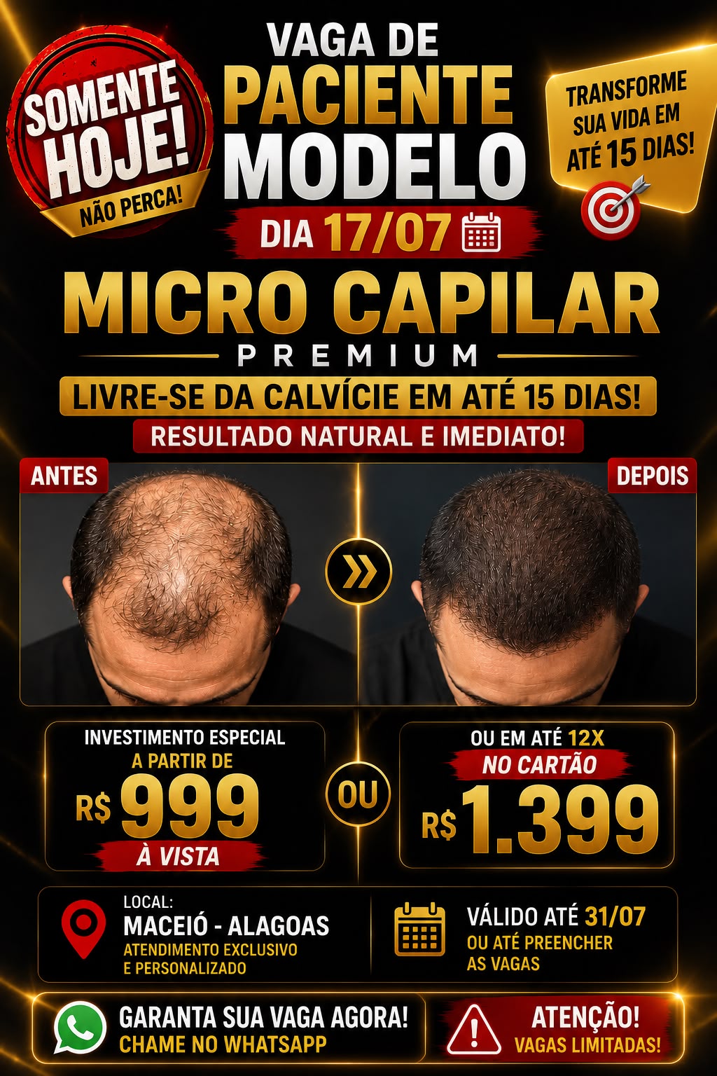 Rafaela Moura Micro Scalp Clinic Facebook ad: QUERO SER PACIENTE MODELO