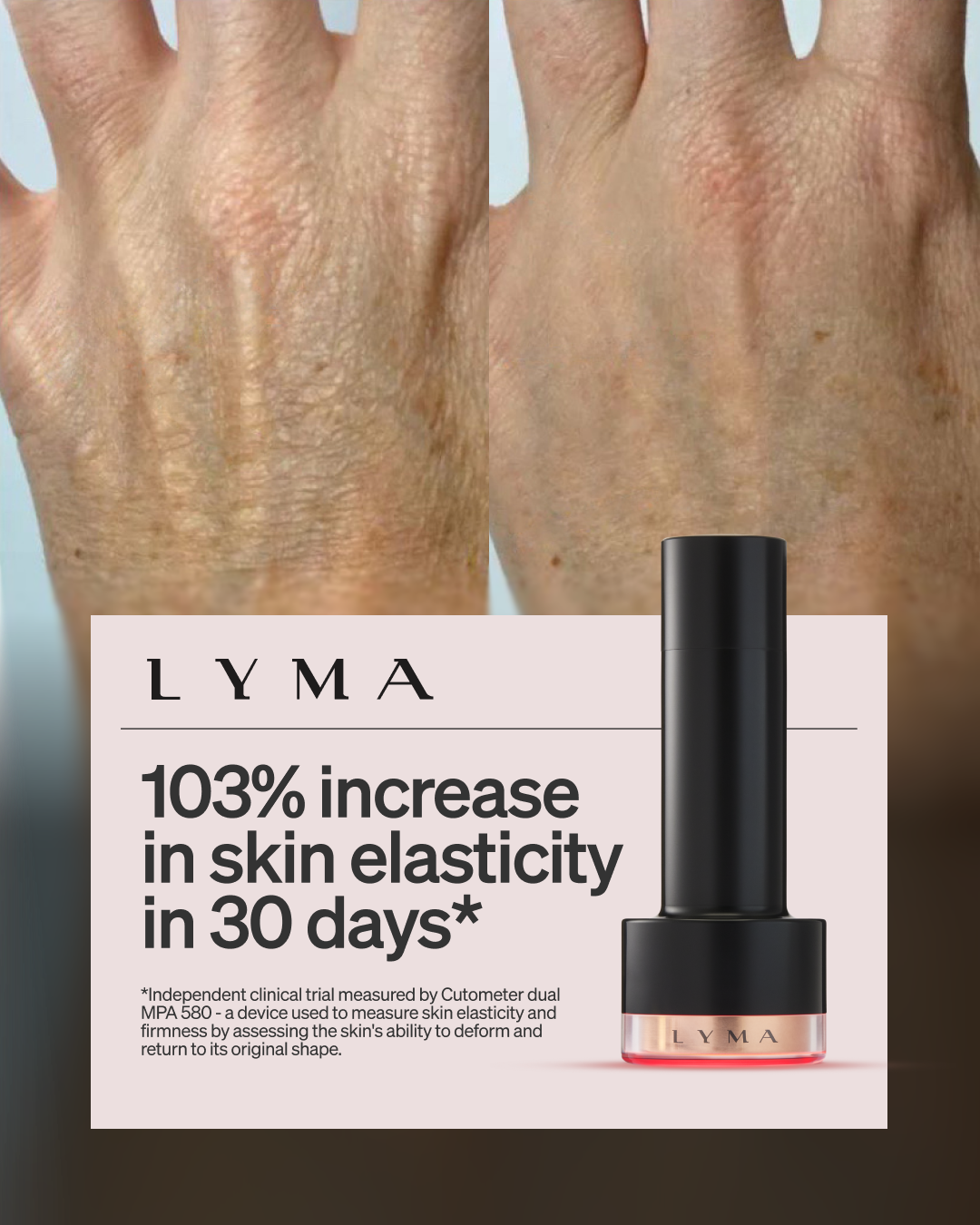 LYMA Facebook ad