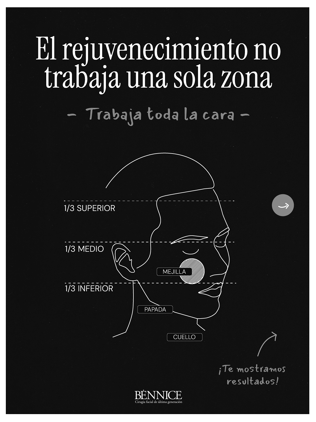 Bennice Estética Facial Facebook ad: El rejuvenecimiento facial no trabaja una sola zona