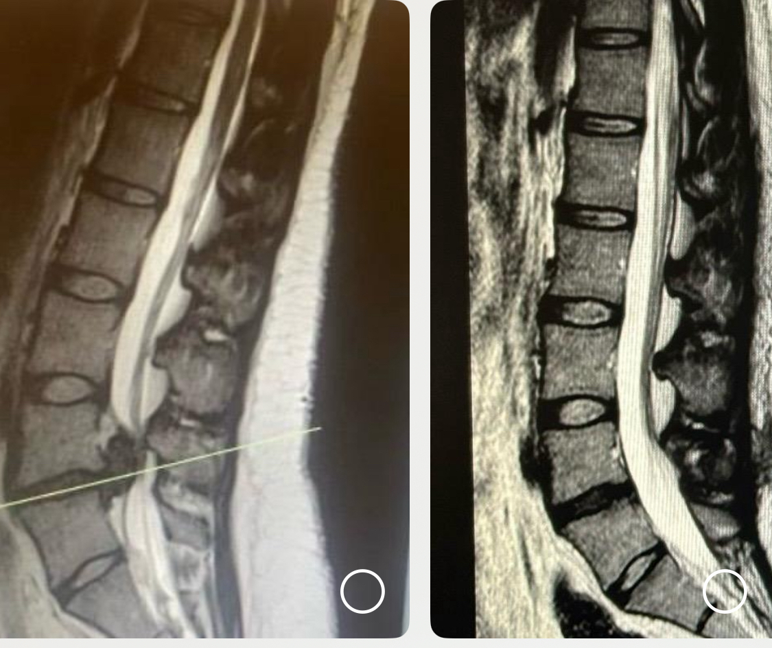 Zentrum für Neuro und WirbelsäulenchirurgieDr. Soliman und Dr. Aslan Facebook ad: Rücken- und Nackenschmerzen zu haben ist mittlerweile eine…