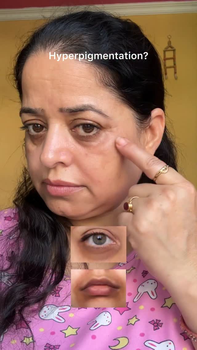 Arencia Global Facebook ad: goodbye dark circles!
