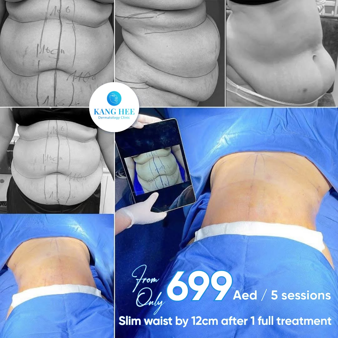 KangHee International Aesthetic Institute Facebook ad: LOSE 10KG-12cm SLIM WAIST