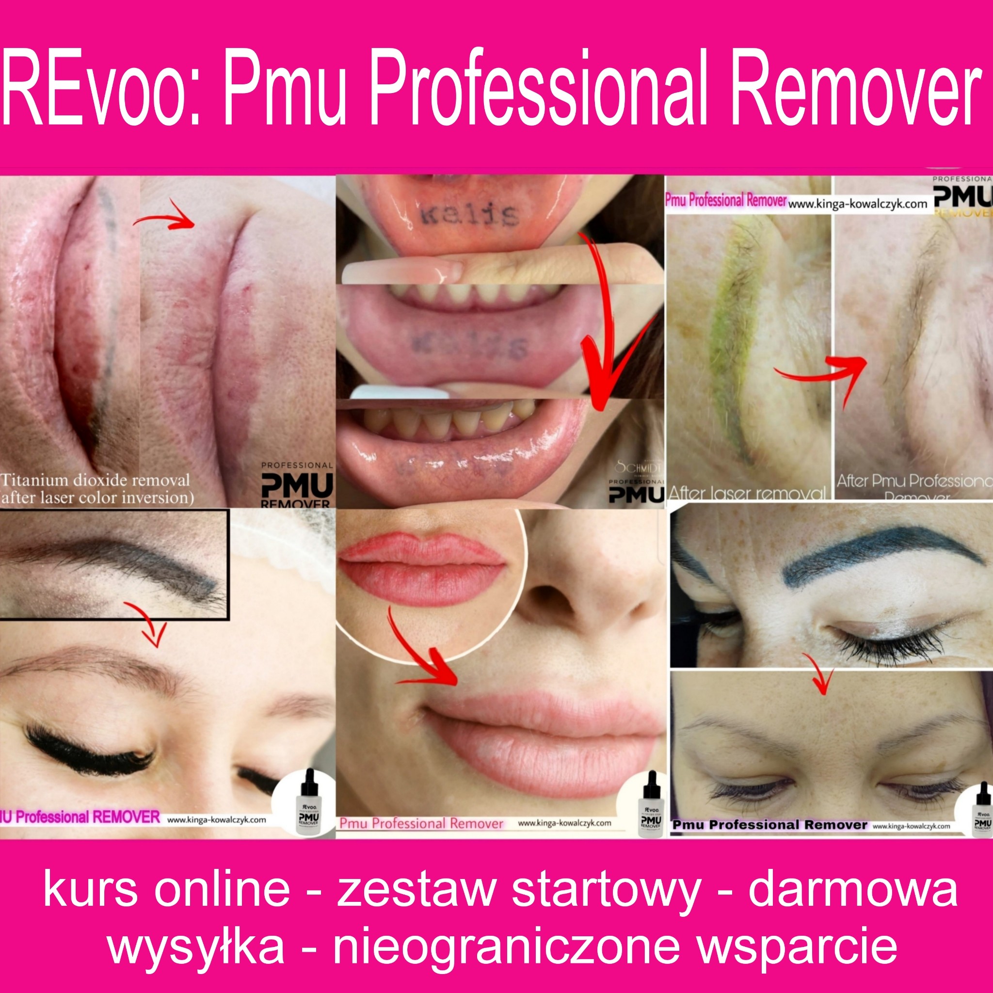 REvoo: PMU Professional & Tats Removers Facebook ad