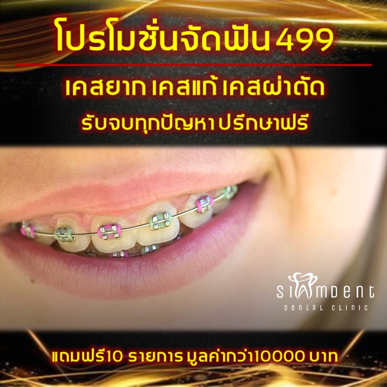 Siamdent Dental Clinic ศูนย์จัดฟัน ทำฟัน - บางหว้า จรัญสนิทวงศ์ พหลโยธิน Facebook ad: โปรโมชั่นจัดฟัน 499 แถมฟรีกว่า 10000 บาท ​