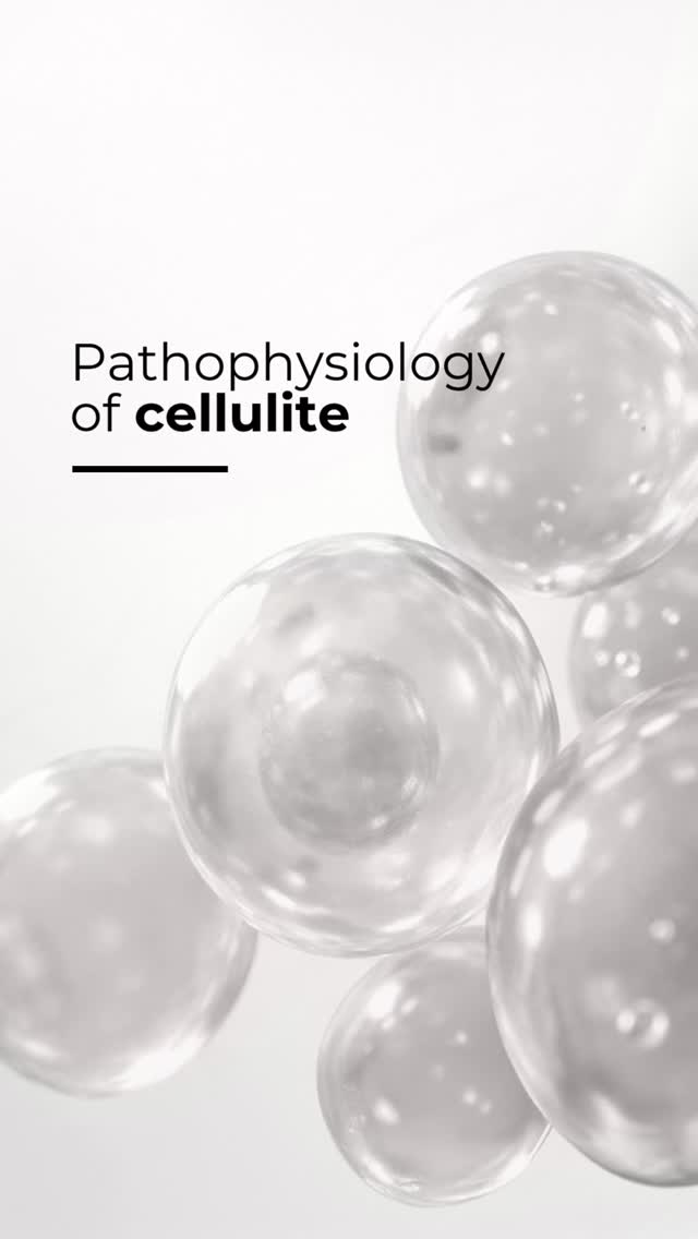 LPG endermologie Facebook ad: Celluliter är resultatet av en komplex fysiologisk process.