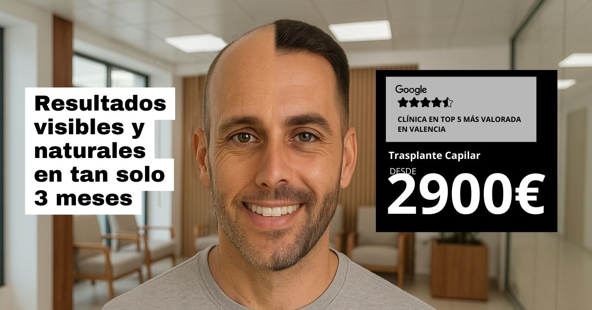 Clínica salud capilar  Facebook ad
