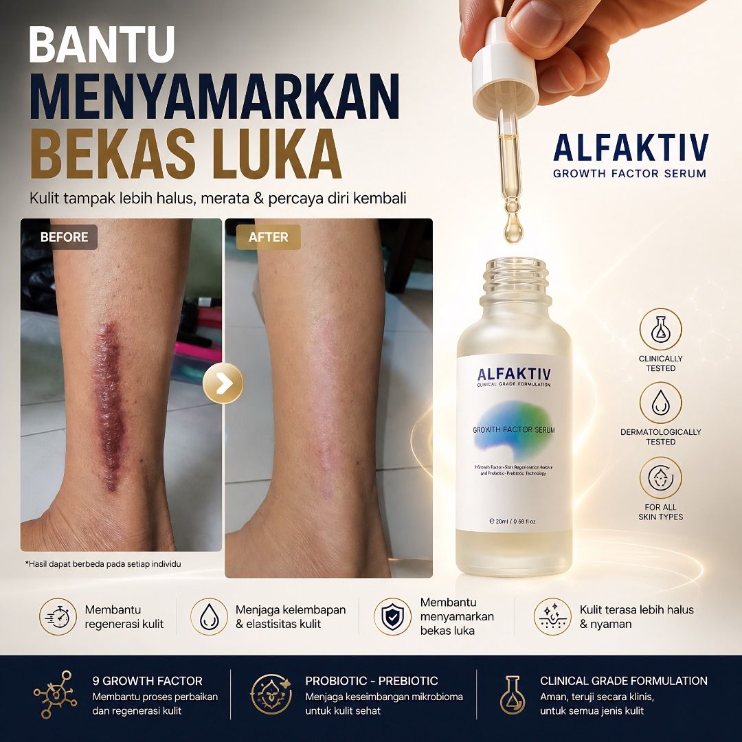 Spesialis Luka Kulit Facebook ad: Nyaman & Aman