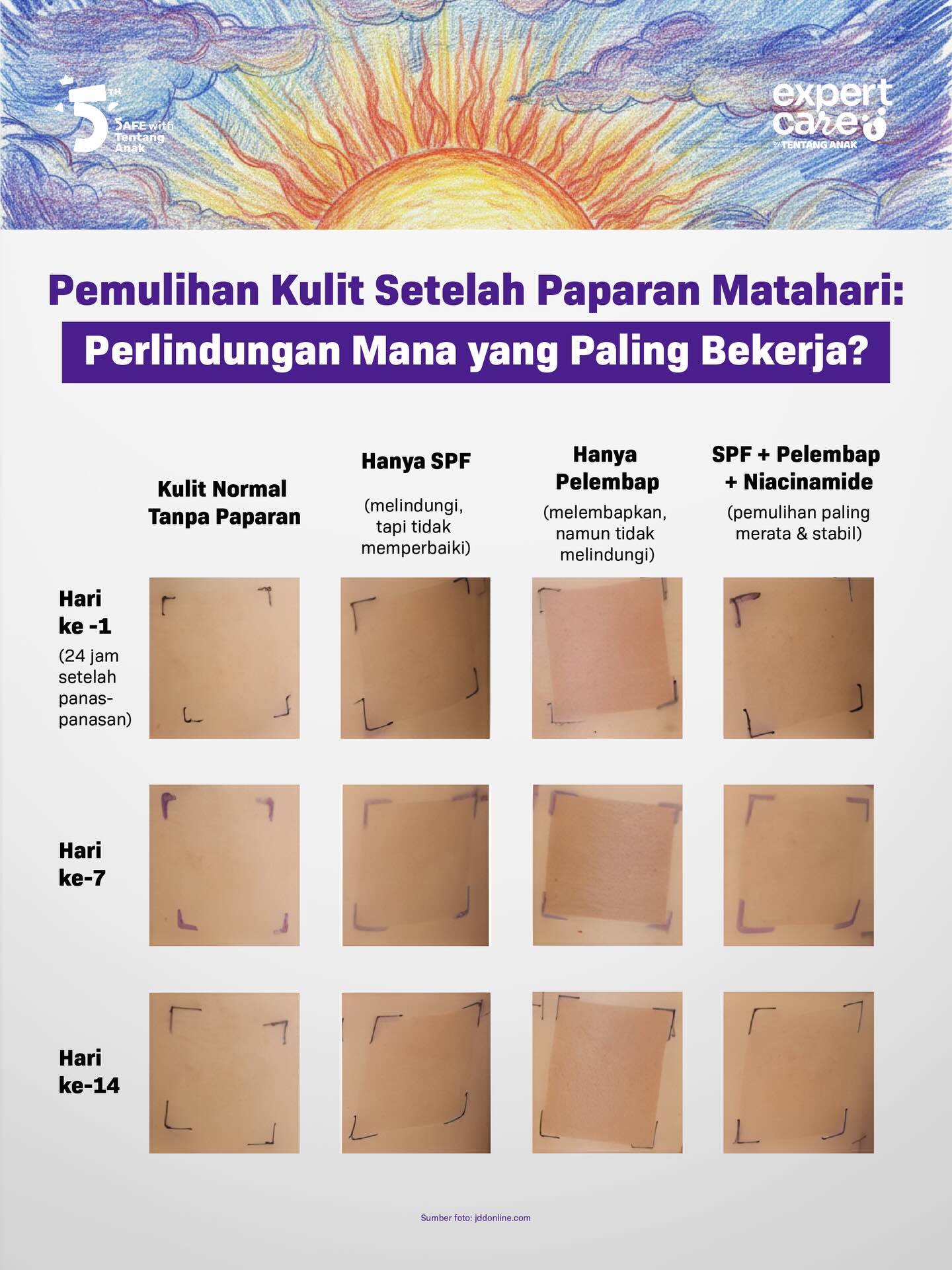 Expert Care Facebook ad: Kulit yang sering kena paparan sinar matahari, apalagi…