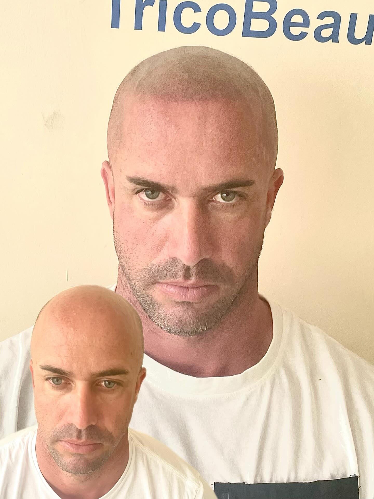 Michele Partipilo Trico Beauty Canarias Facebook ad: La varita mágica no existe… pero casi