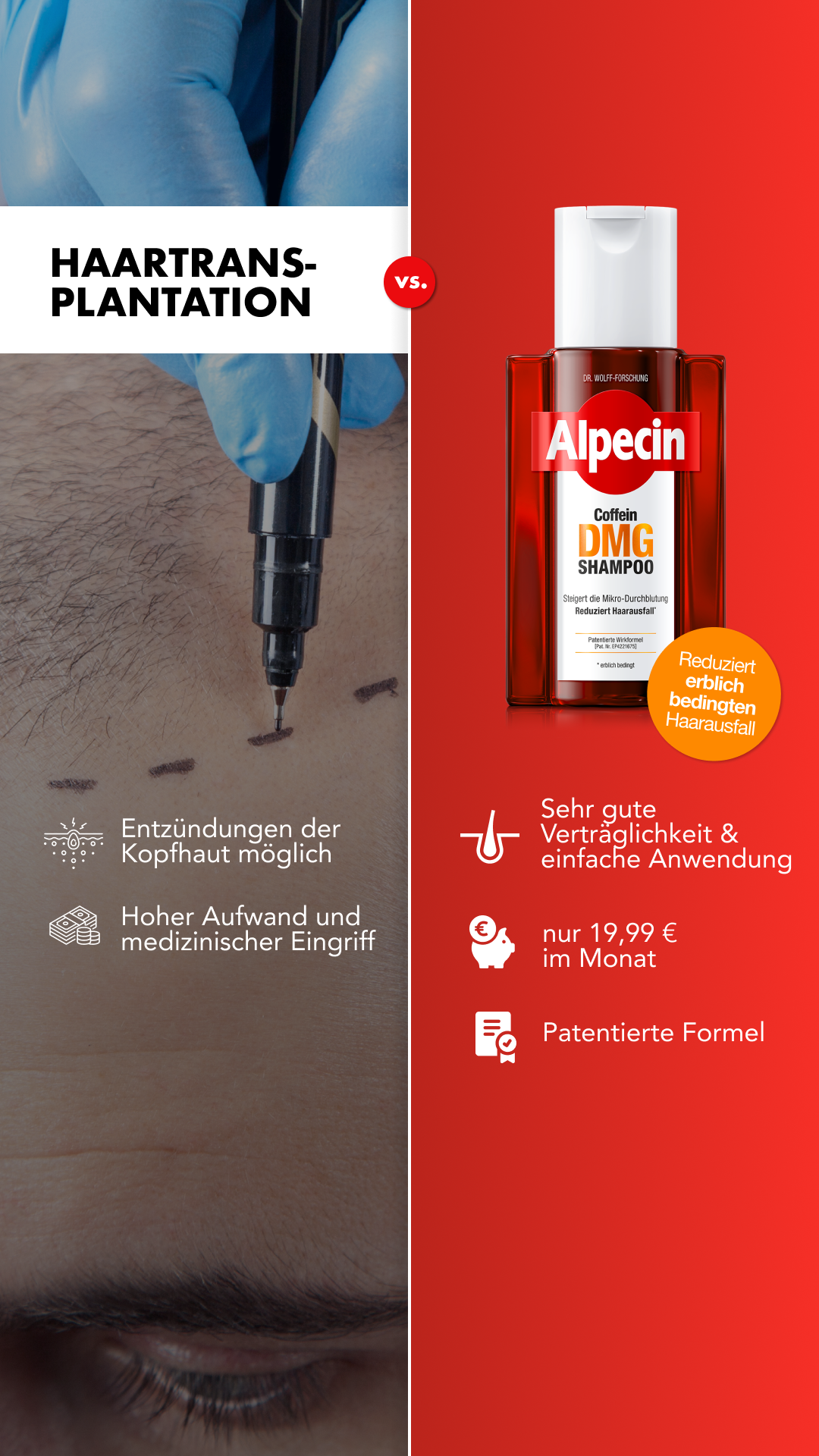 Alpecin Facebook ad