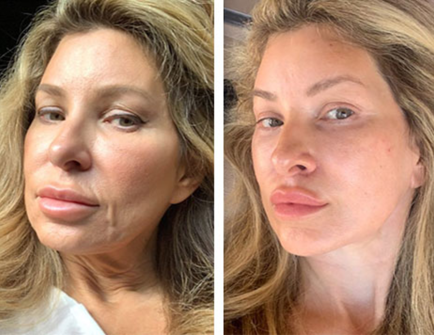 Together through Aging Facebook ad: Read this if you were told that facelift surgery was your…