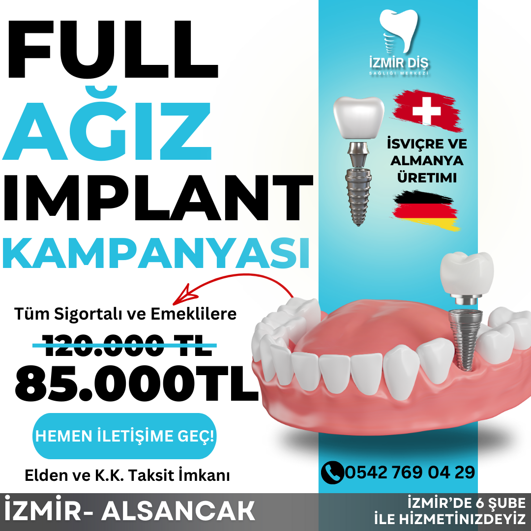 Ege Diş Sağlığı Merkezi Facebook ad: Full Ağız İmplant 85.000TL