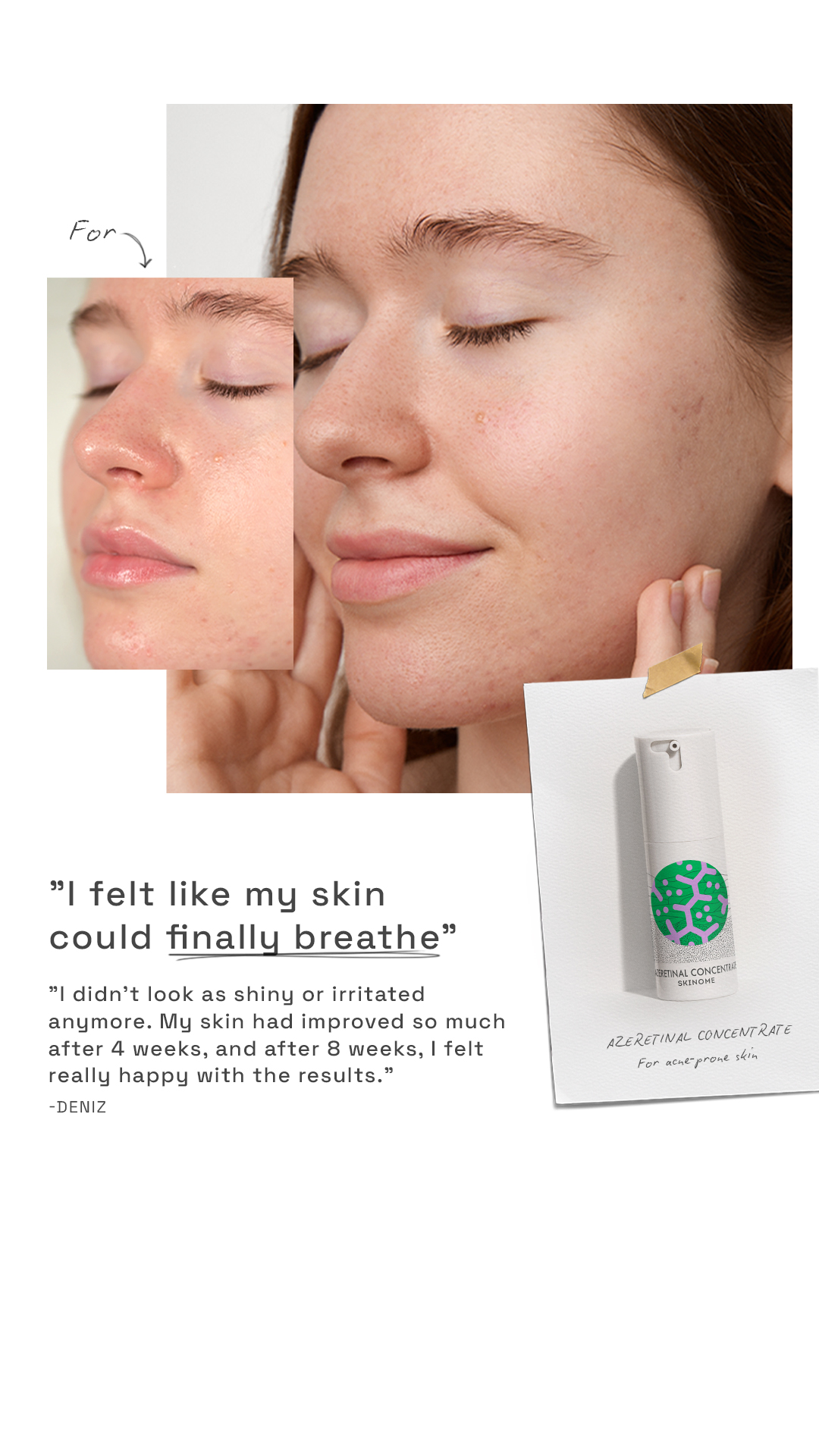Skinome Facebook ad