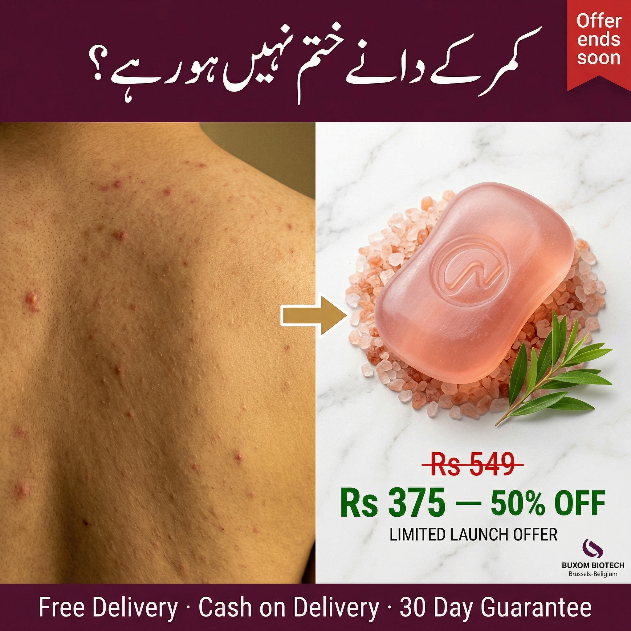 Buxom Biotech Facebook ad: Body Acne Ka Natural Ilaaj -
