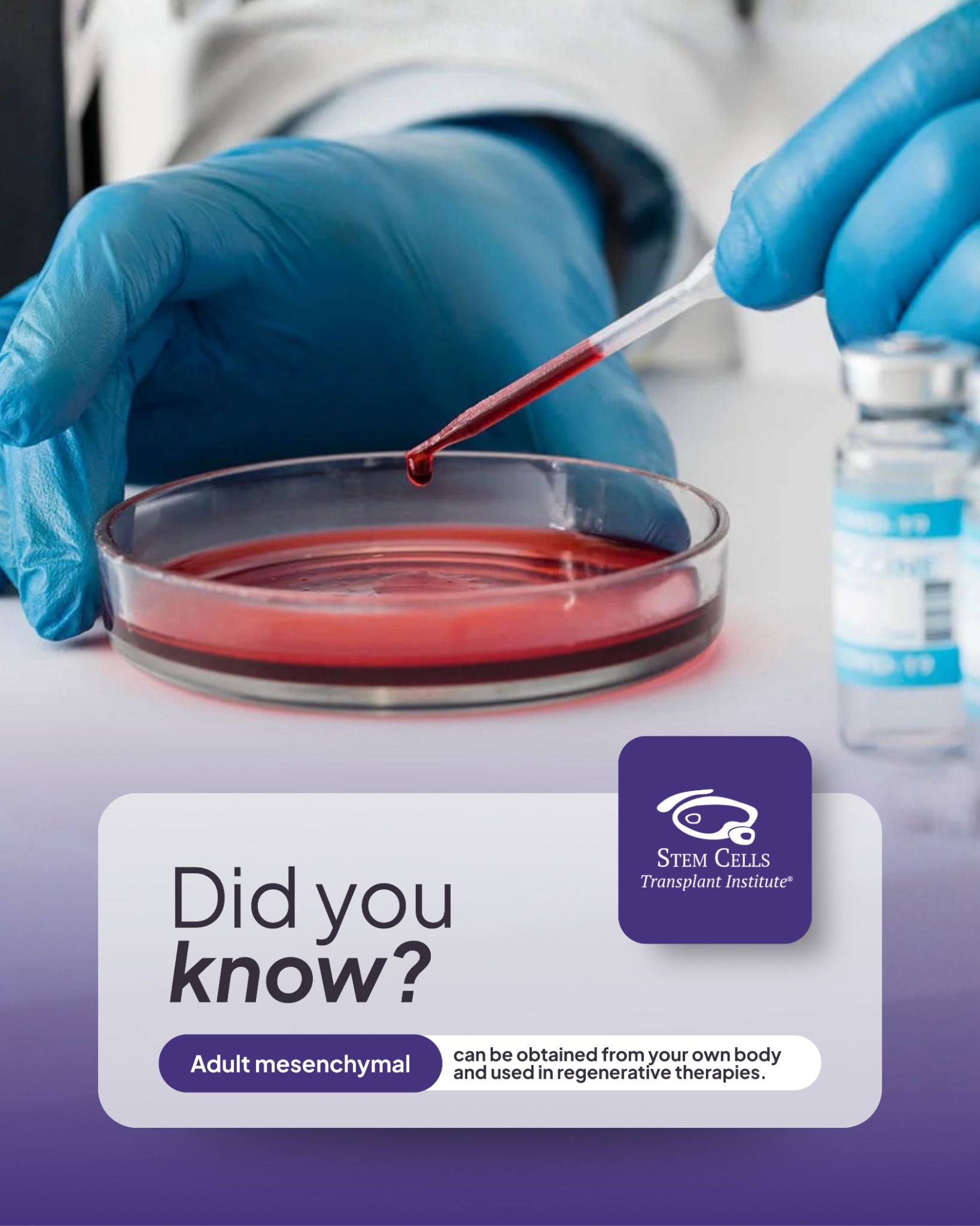 Stem Cells Transplant Institute Facebook ad