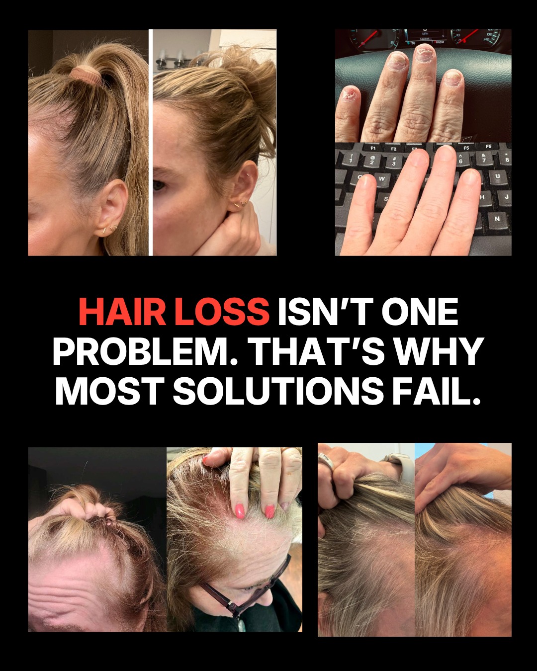 Silver Fern Brand Facebook ad: We took the hair supplement game to the…