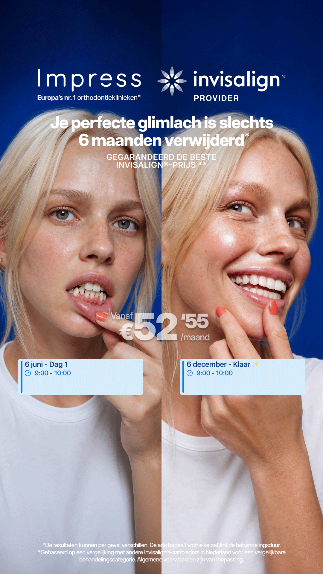 Impress Nederland Aligners Facebook ad