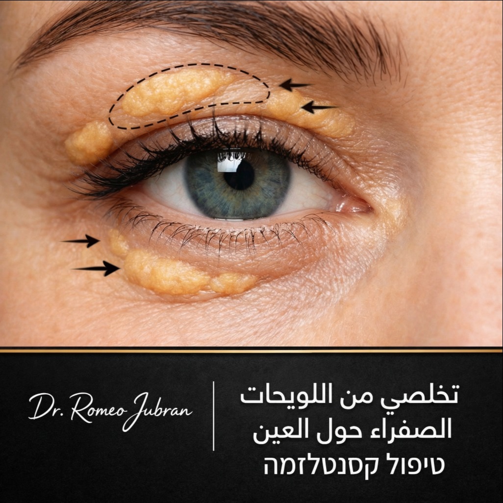 Dr. Romeo Jubran- Aesthetics Medical Clinic Facebook ad