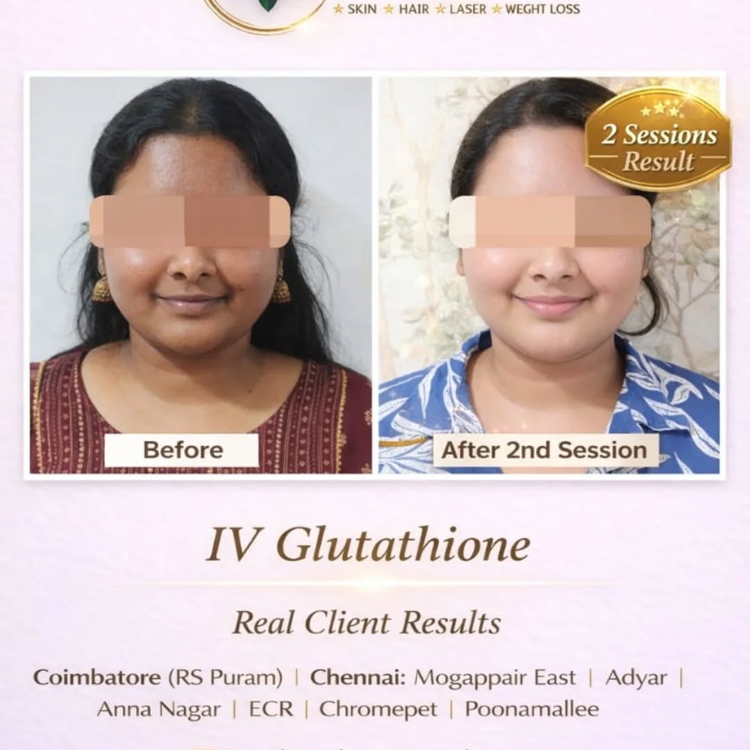 Everglo rs puram Facebook ad