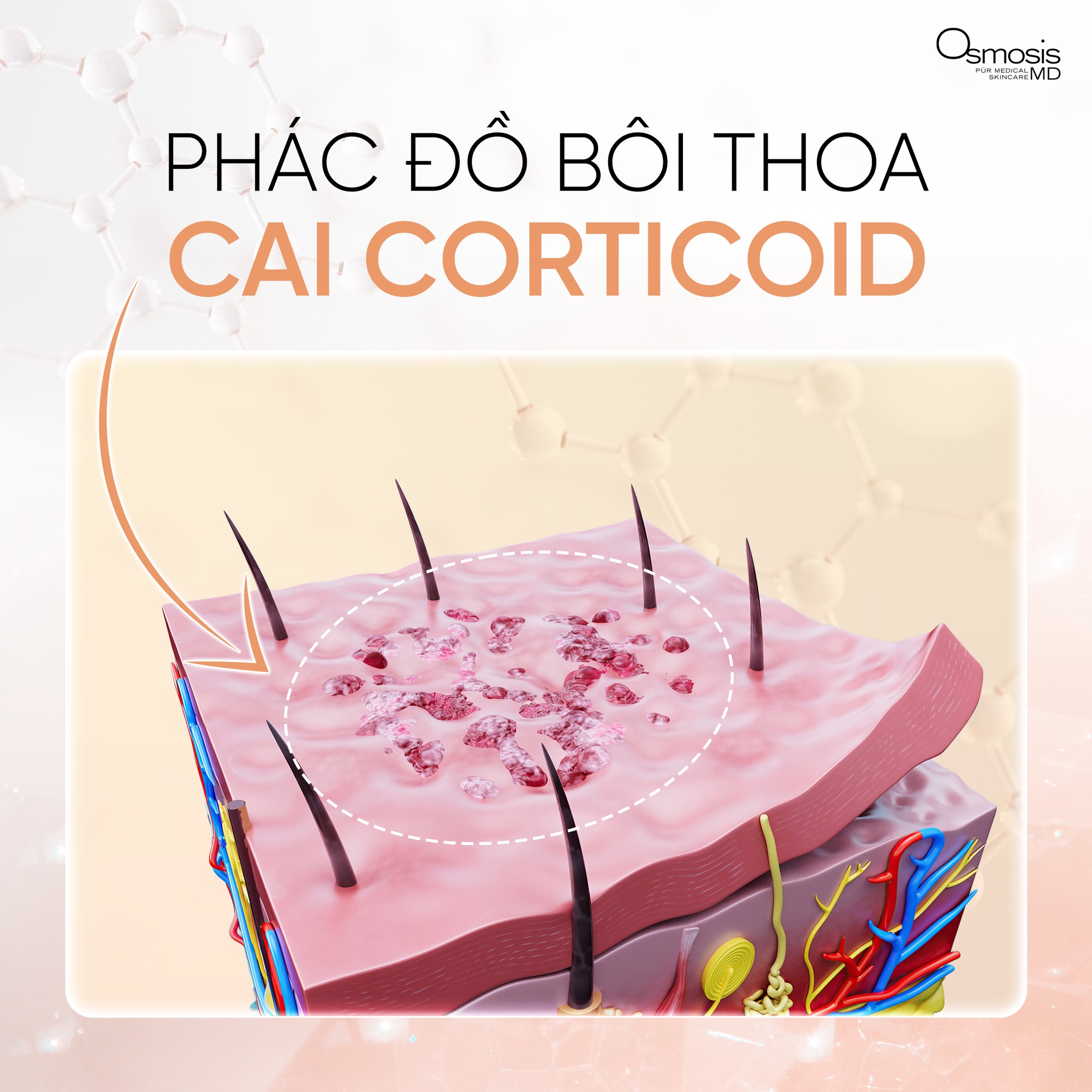 Osmosis Beauty Vietnam Facebook ad: DÙNG CORTICOID SAI CÁCH - HIỂU ĐÚNG ĐỂ…