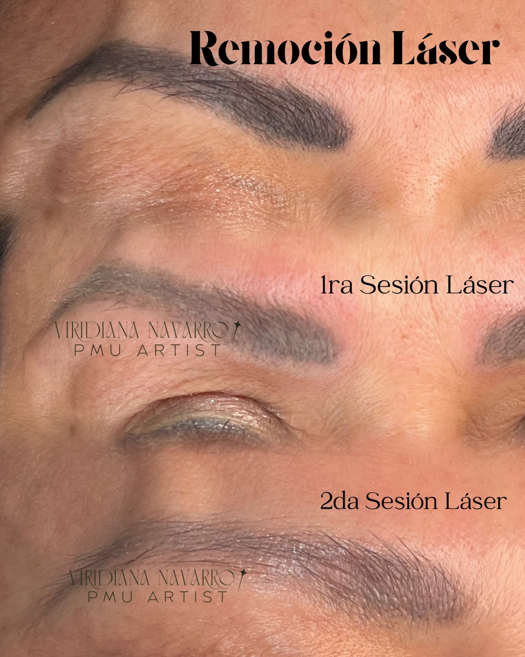ELLE BROWS CLINIC Facebook ad: Muchas personas llegan conmigo porque su micropigmentación…