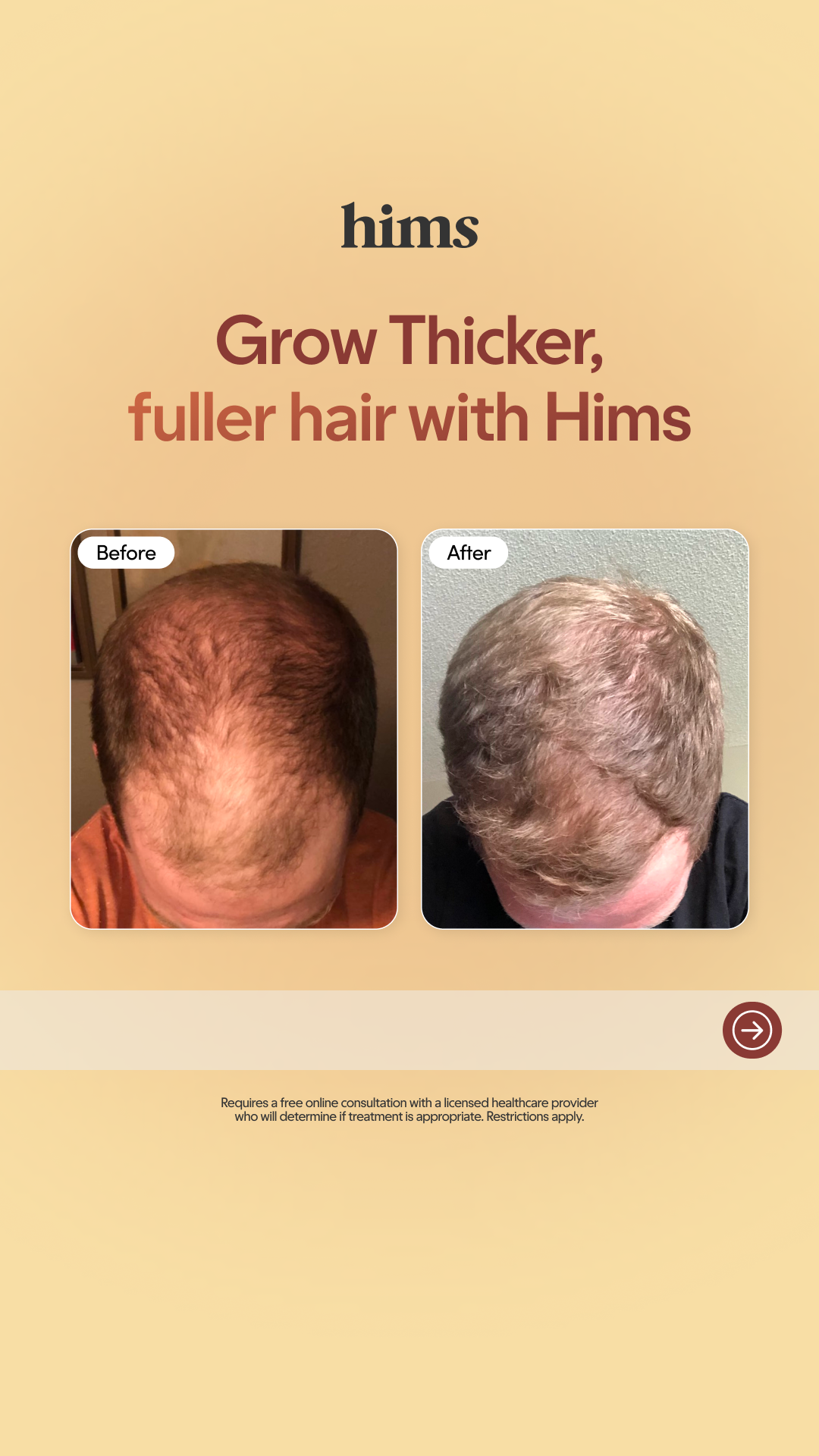 hims Facebook ad
