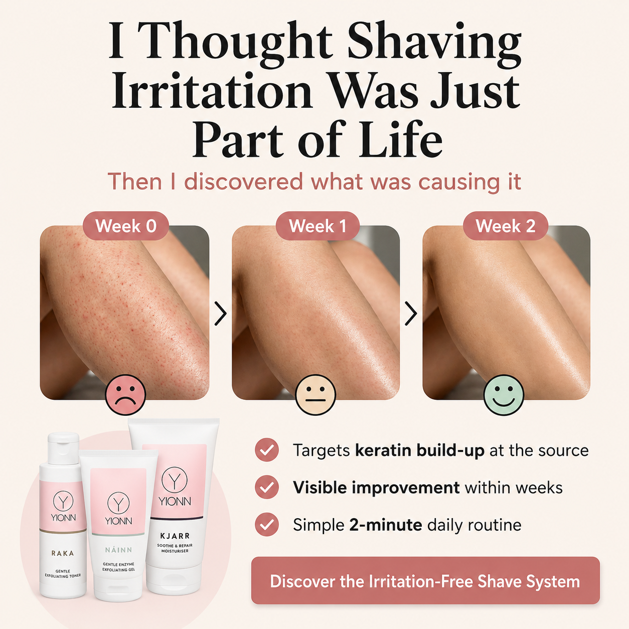 YIONN Facebook ad: What if it isn't your sensitive skin?