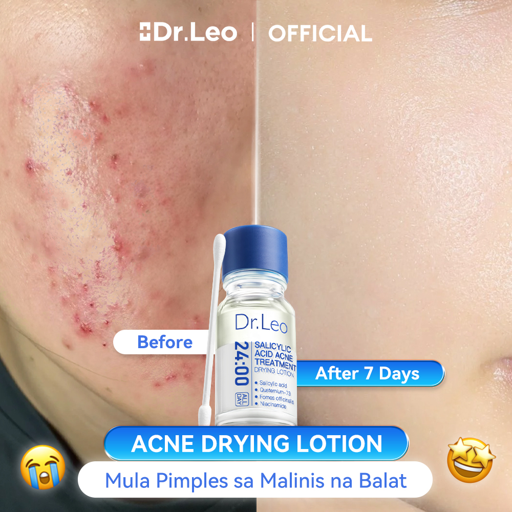 Dr.Leo Shop Facebook ad: Maramdaman ang mahika ng Salicylic Acid