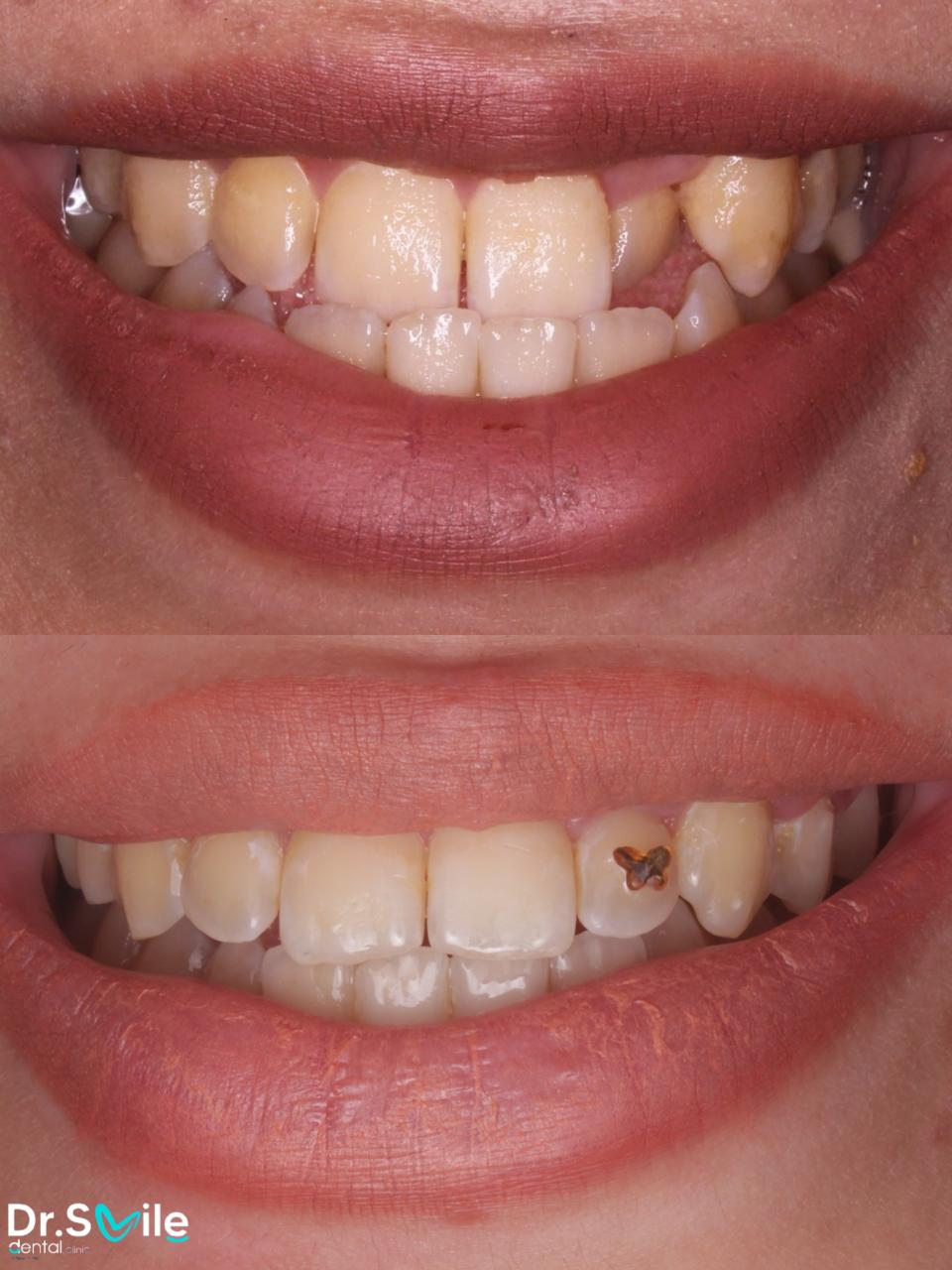 Dr.Smile Dental Clinic - لزراعة وتجميل الأسنان Facebook ad