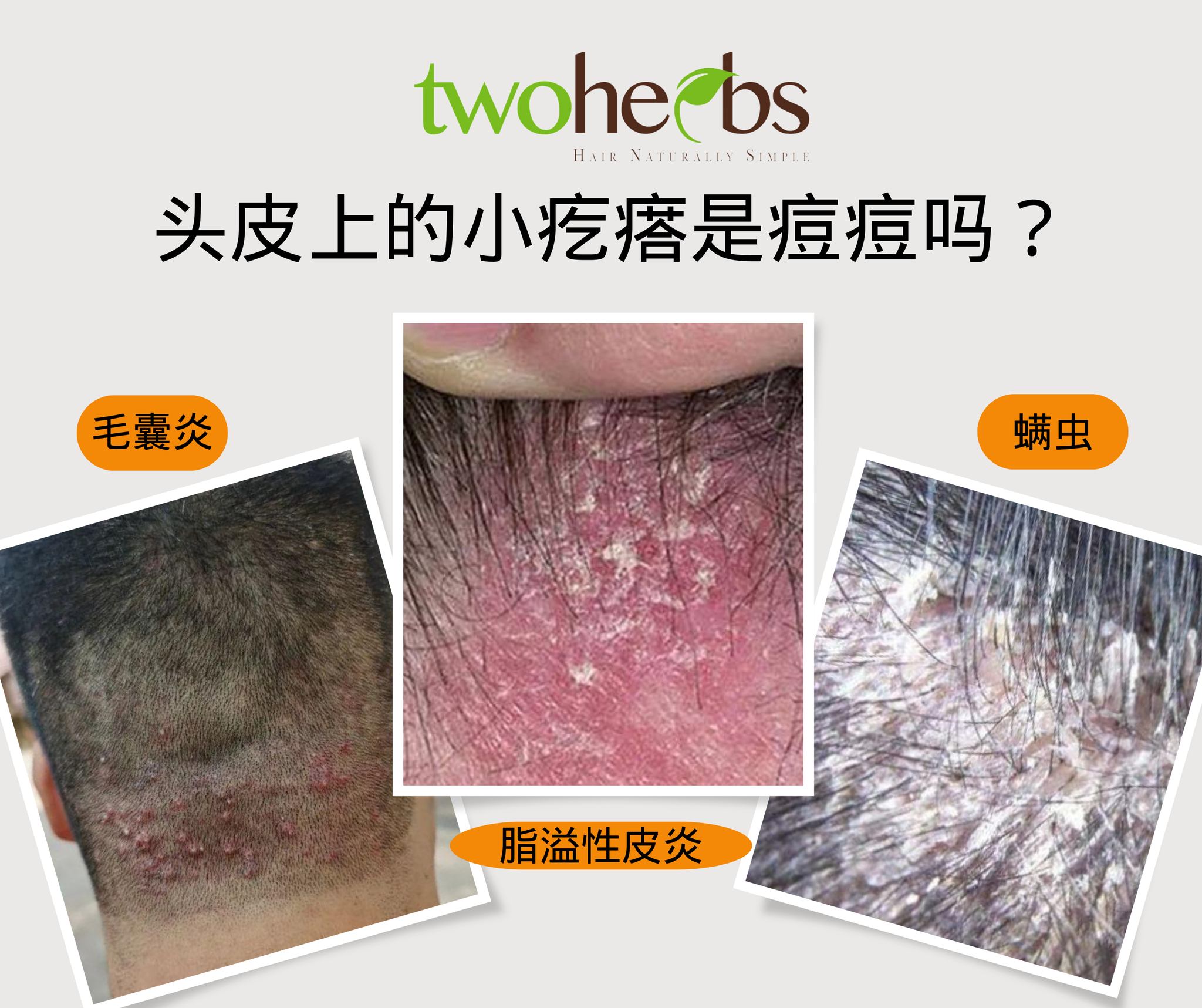 Natural Herb Hair Treatment Sdn Bhd Facebook ad: 别扣!