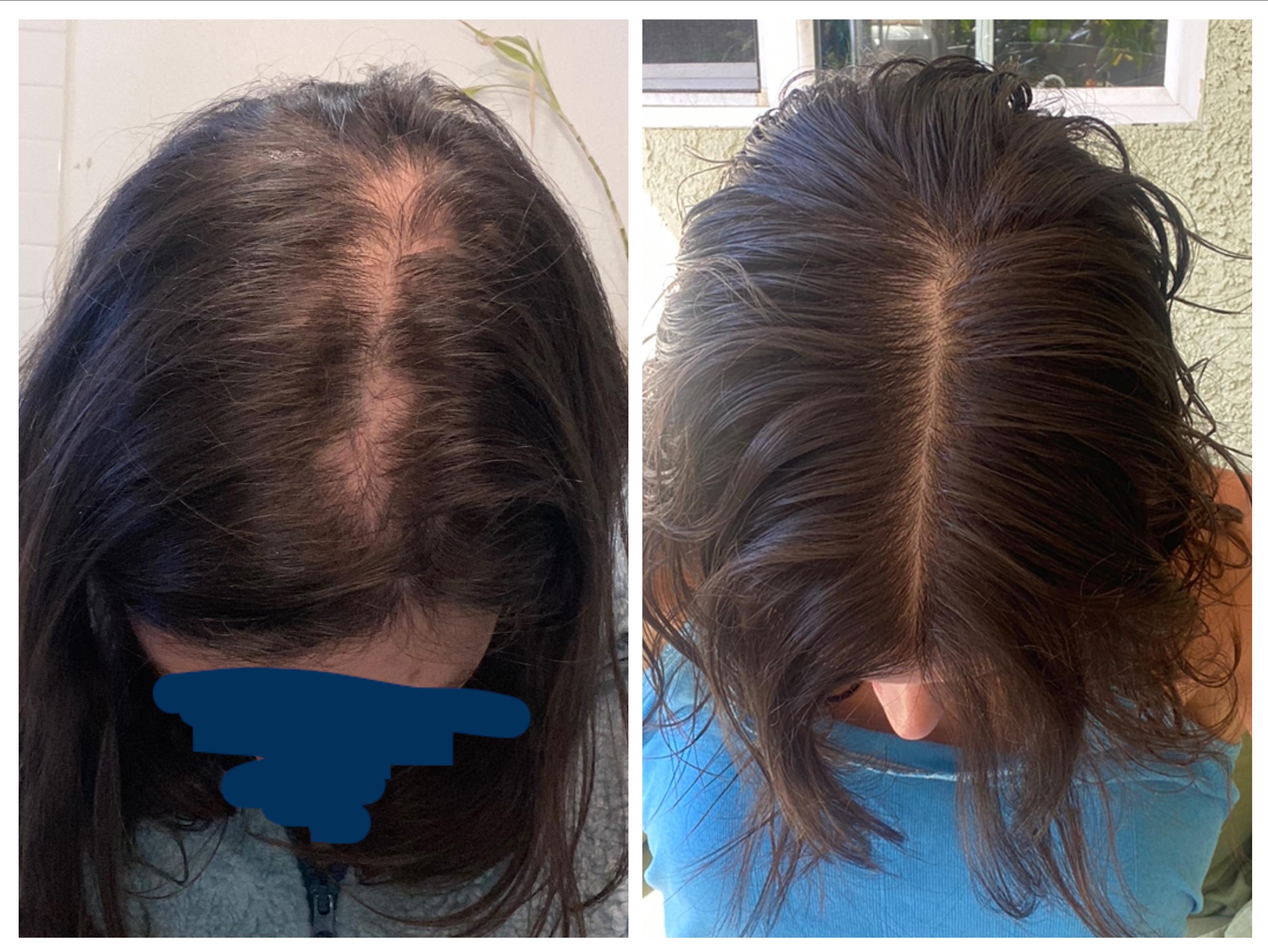 Thyroid Hair Secrets Facebook ad: Read this if the medication that's supposed to help is…