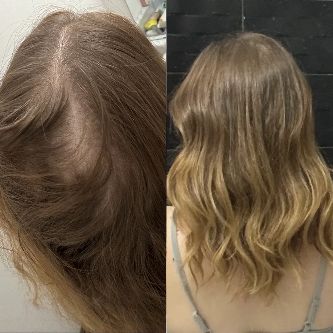 Jennifer Nelson Facebook ad: Reverse GLP-1 Hair Loss