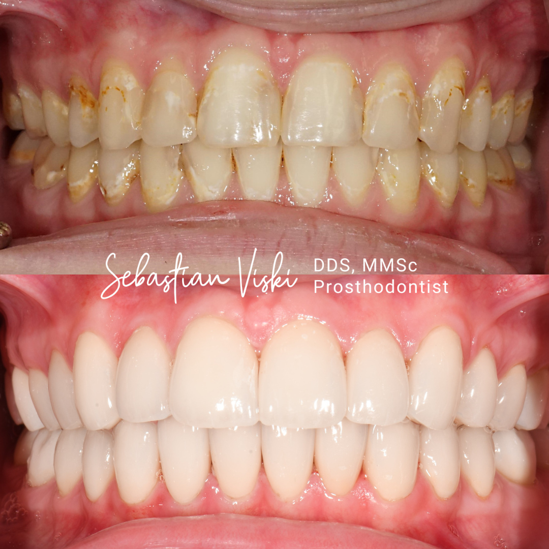 Bonilla Dental Arts Facebook ad