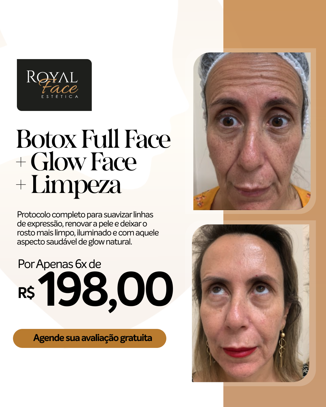 Royal Face Facebook ad