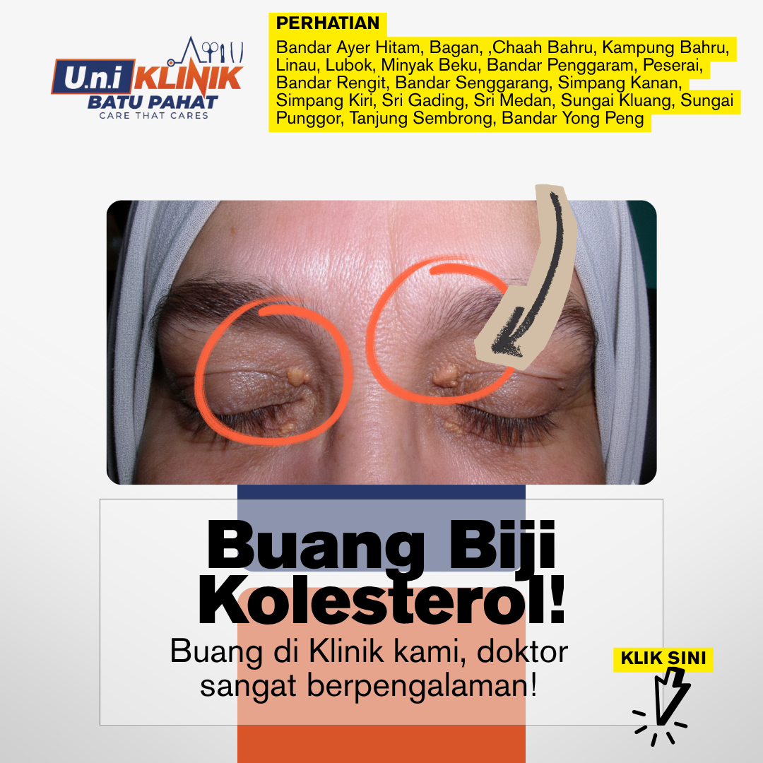 Uni Klinik Batu Pahat Facebook ad: Jom kita buang Biji Kolesterol dengan BETUL!