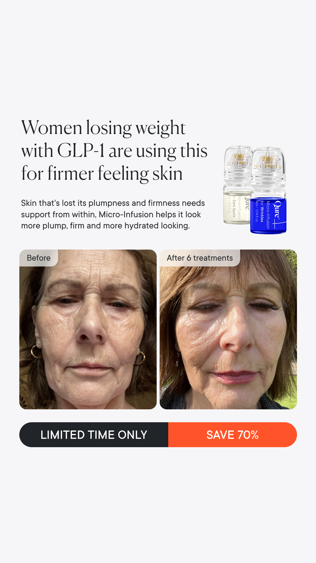 Qure Skincare Facebook ad