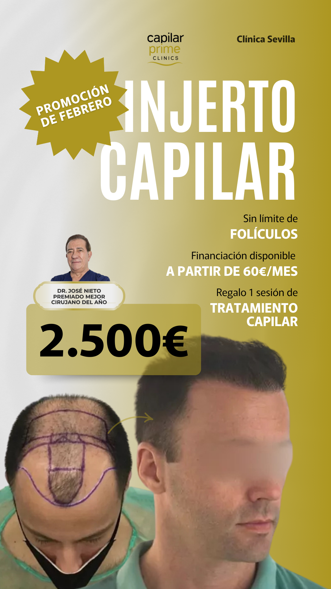 Capilar Prime Clinics Facebook ad from Mar 4, 2026