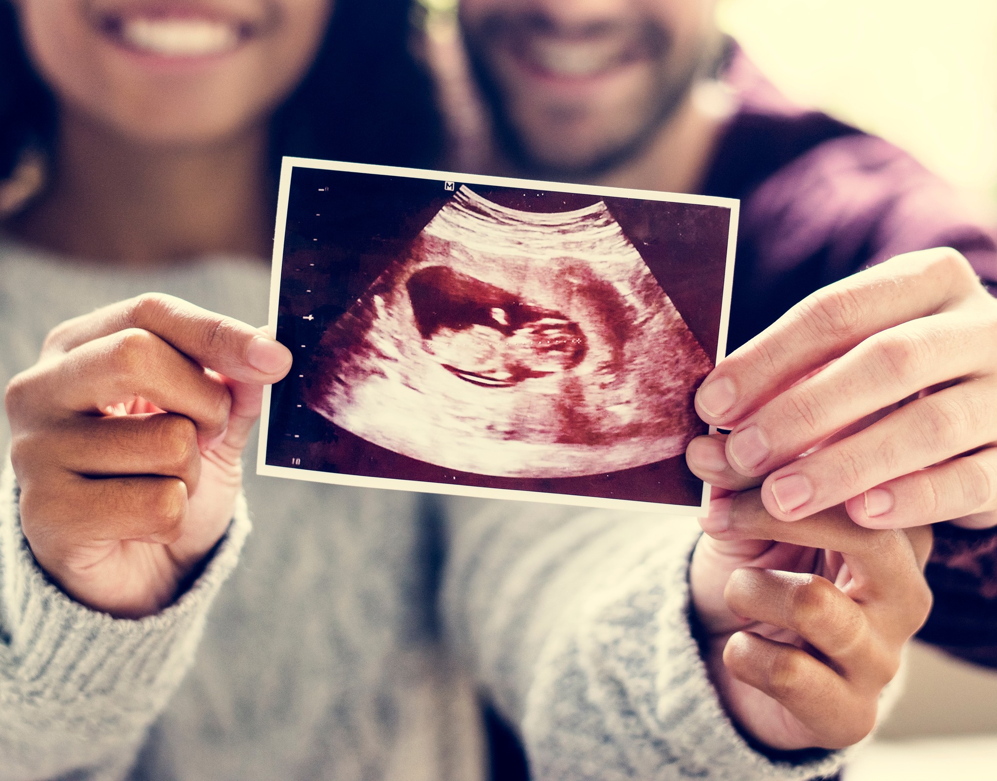 Cherished Moments Facebook ad: Baby Scan | Cherished moments gender reveal | Sonographer