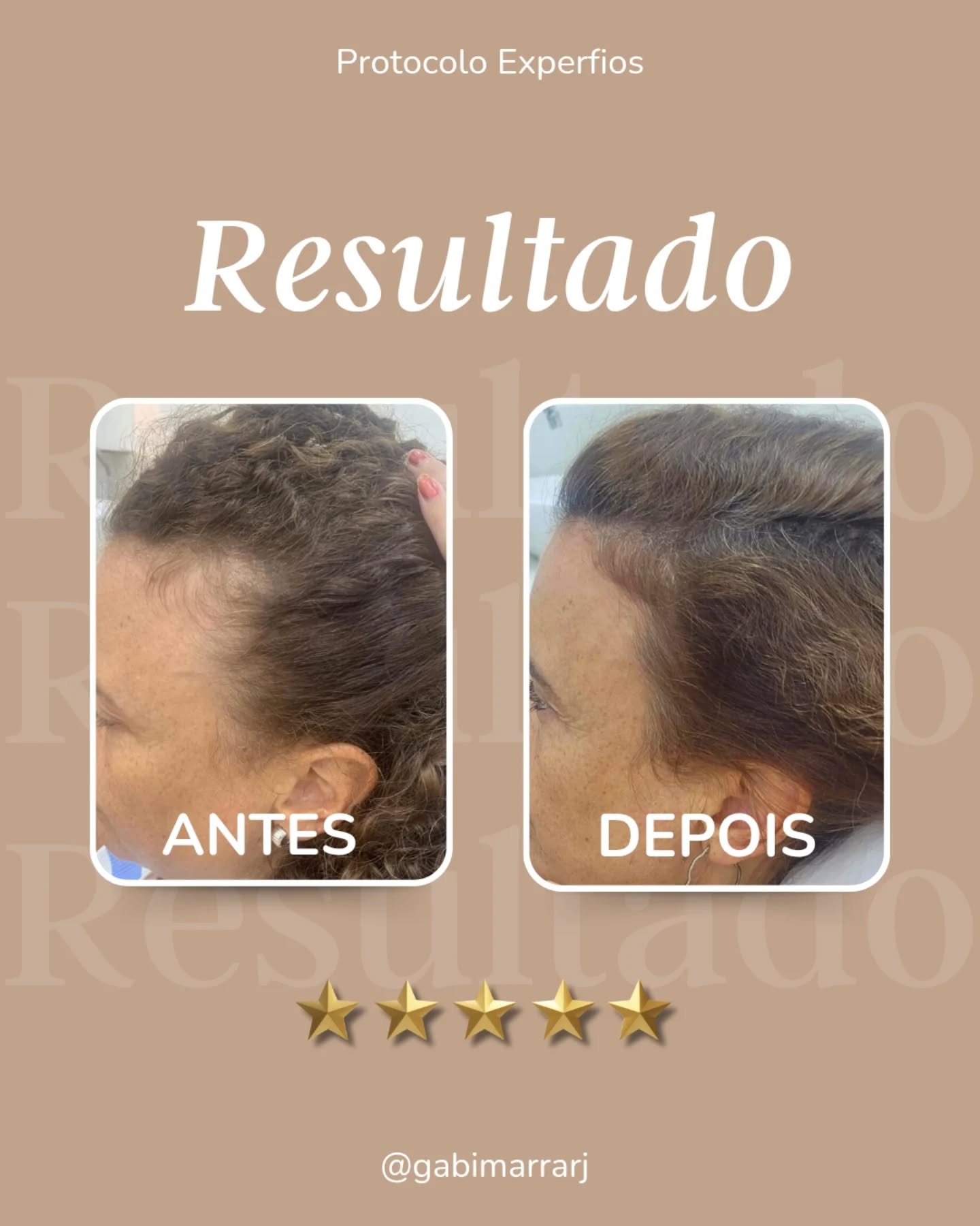 Gabi Marra Facebook ad: Transformação real com o Protocolo Experfios