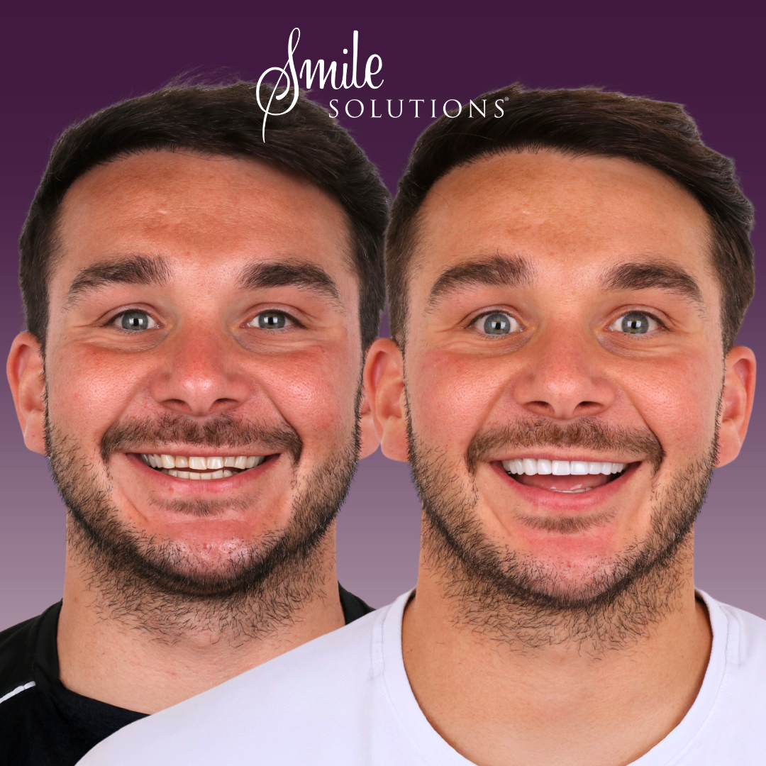 Smile Solutions- Melbourne's Home of Dentistry Facebook ad