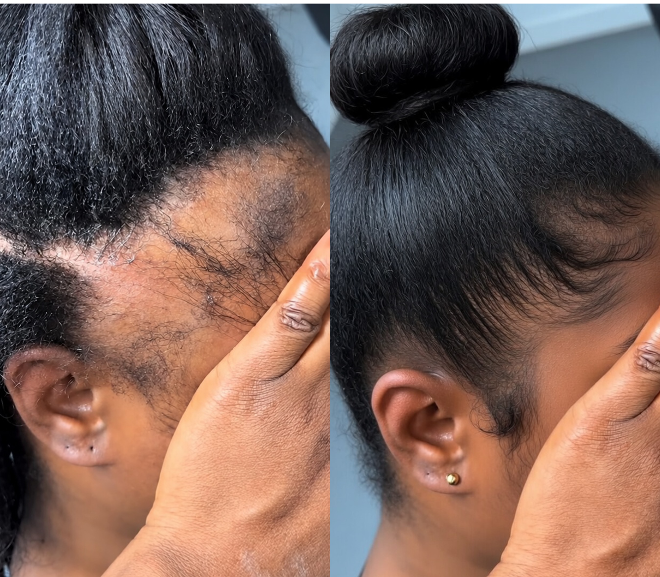 Castoura Facebook ad: Stop Hair Shedding Before It Gets Worse