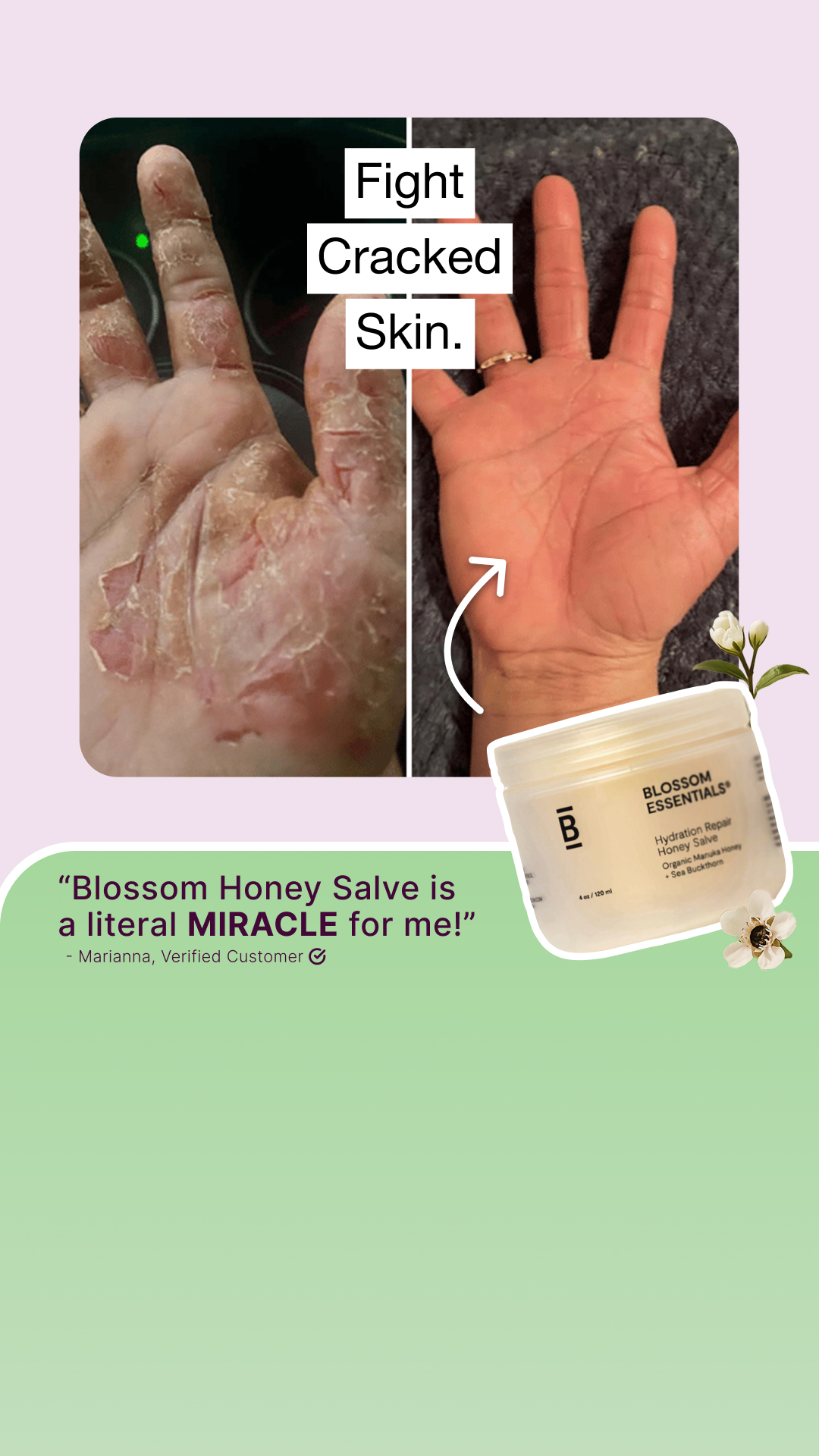 Blossom Essentials Skin Facebook ad