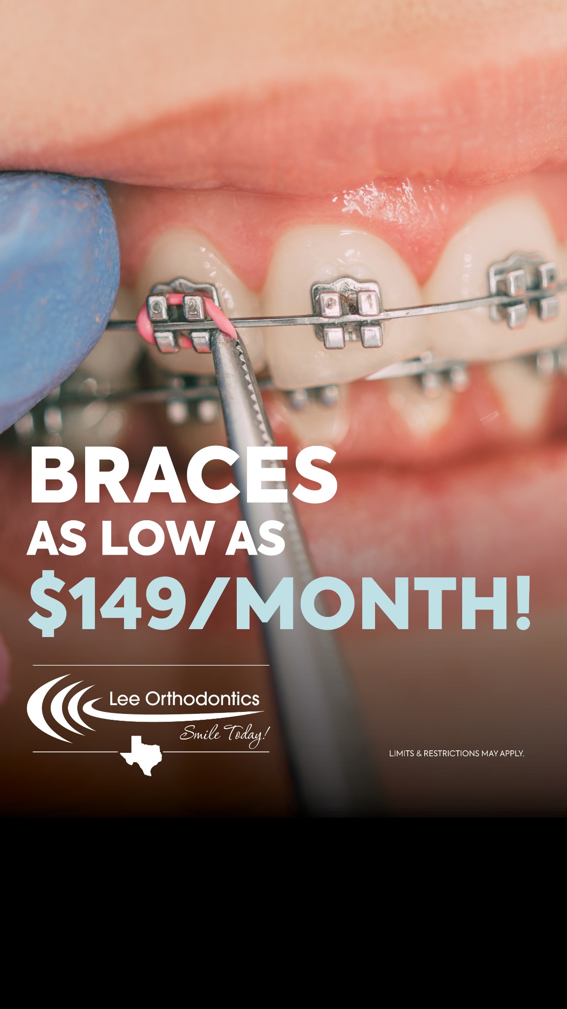 Lee Orthodontics Facebook ad from Nov 20, 2025
